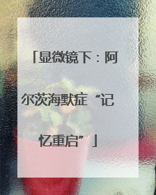 显微镜下：阿尔茨海默症“记忆重启”